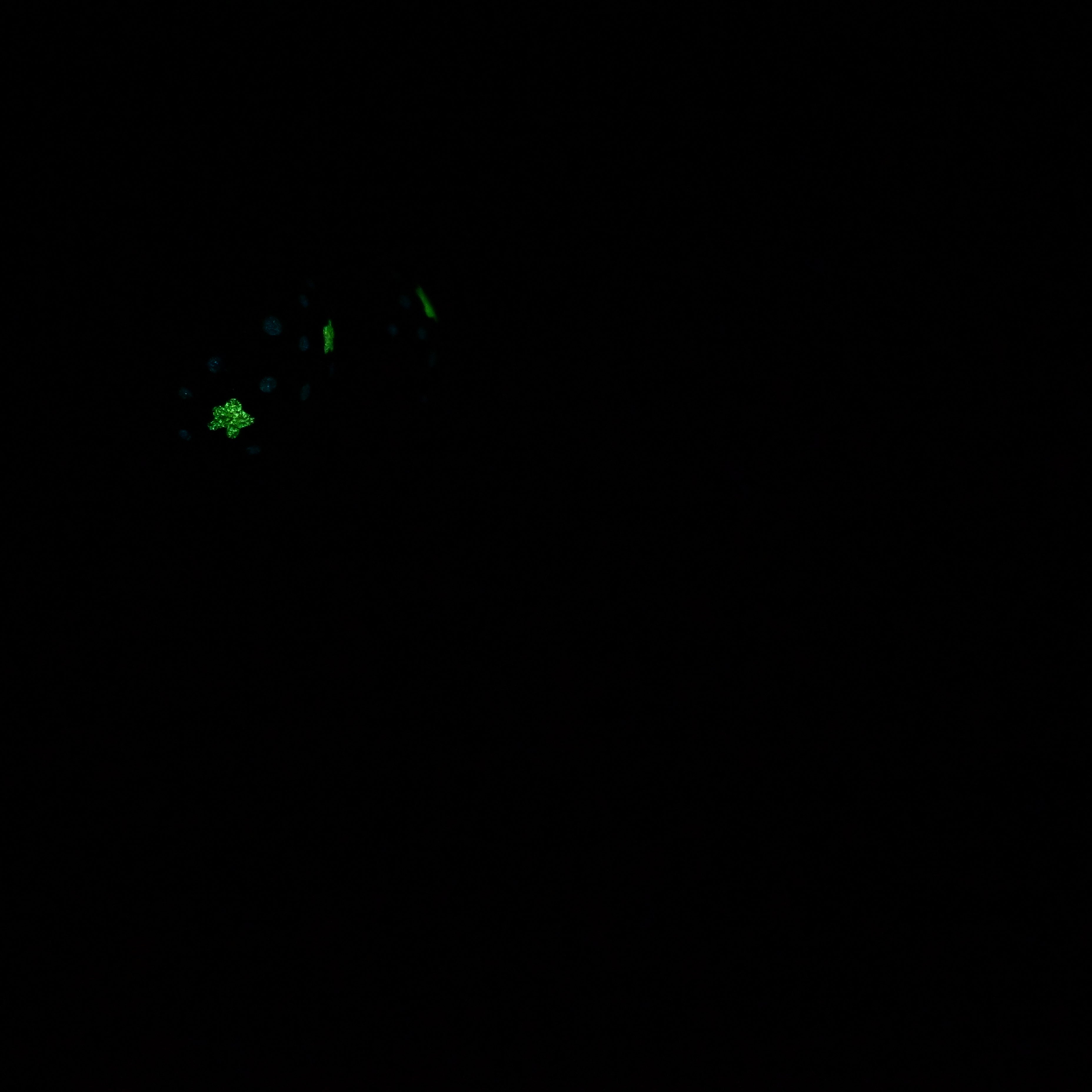 W3SKA47 Tellus Medium 0030 UV GITD CS