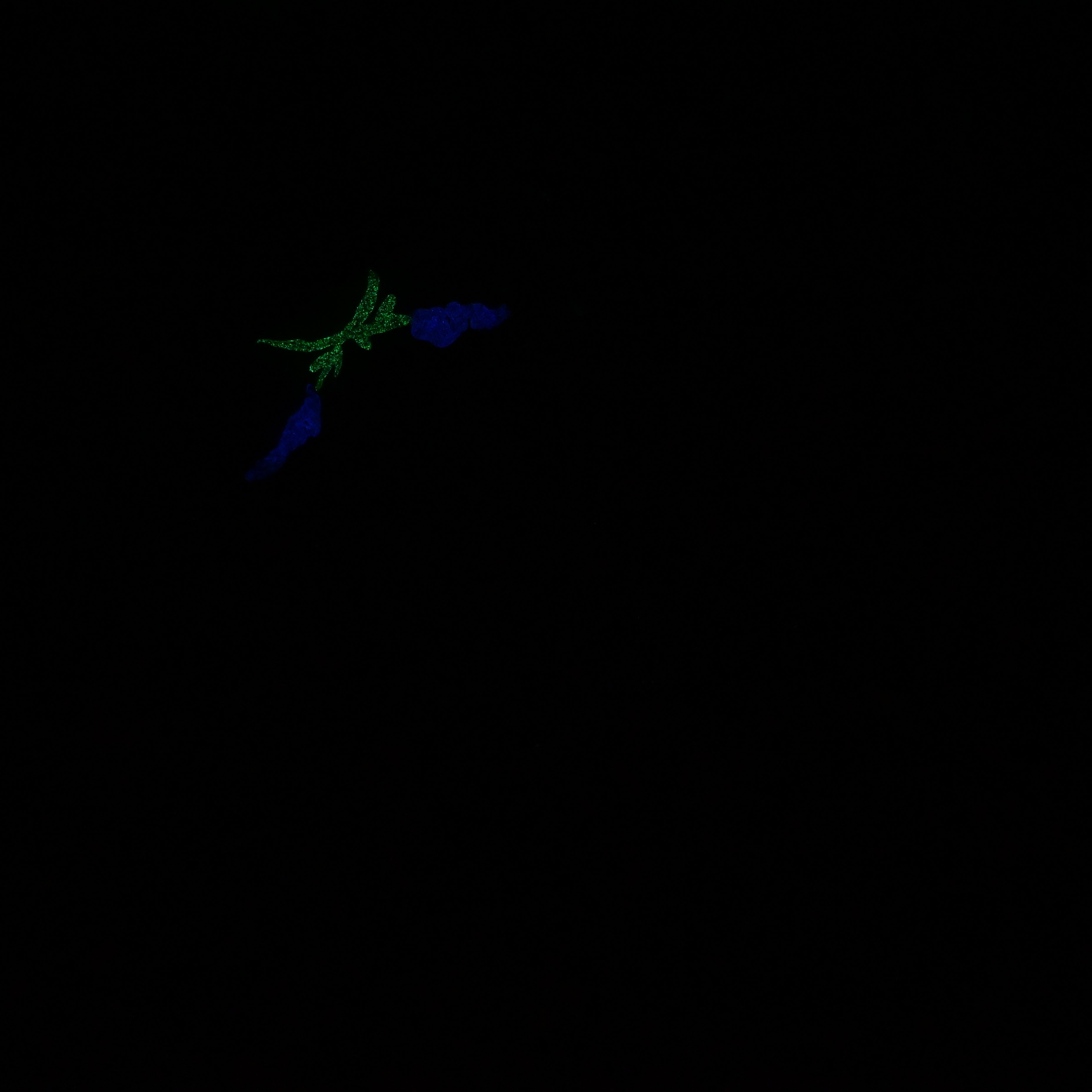 A3MKB11 Auren Medium 0050 UV GITD